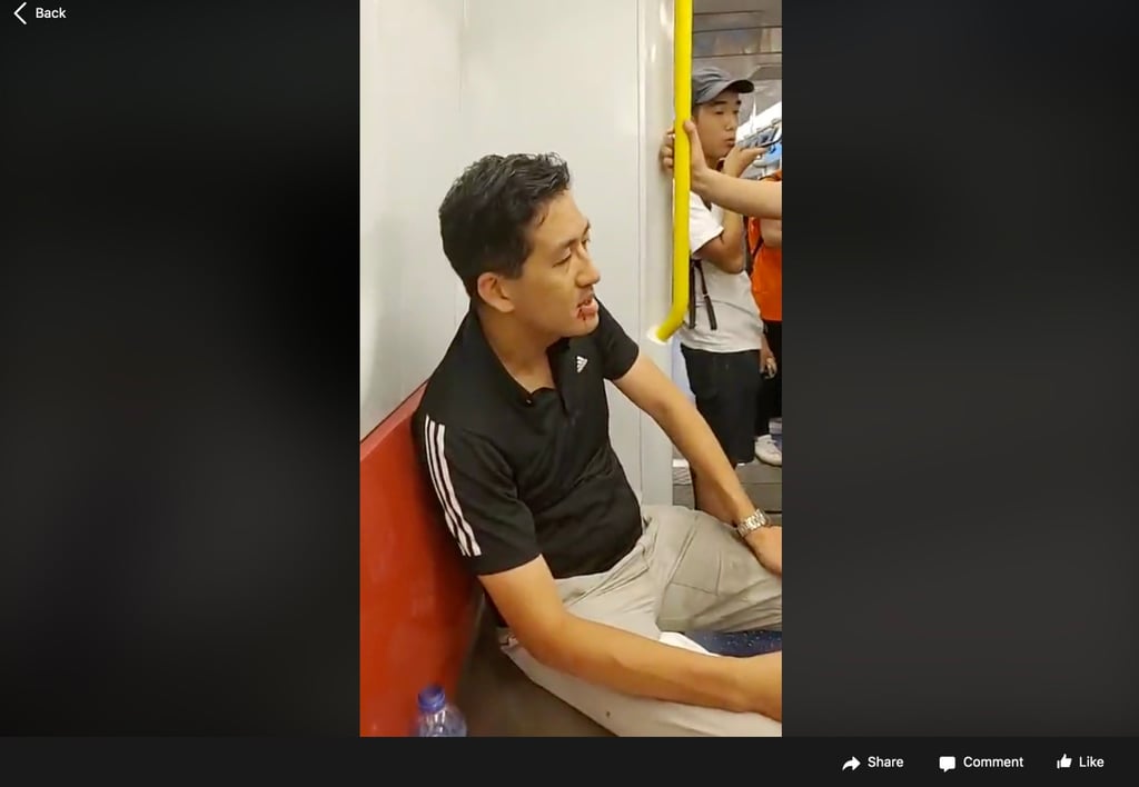 A screengrab from a video shows Lam Cheuk-ting injured during the violence. Photo: Facebook A screengrab from a video shows Lam Cheuk-ting injured during the violence. Photo: Facebook