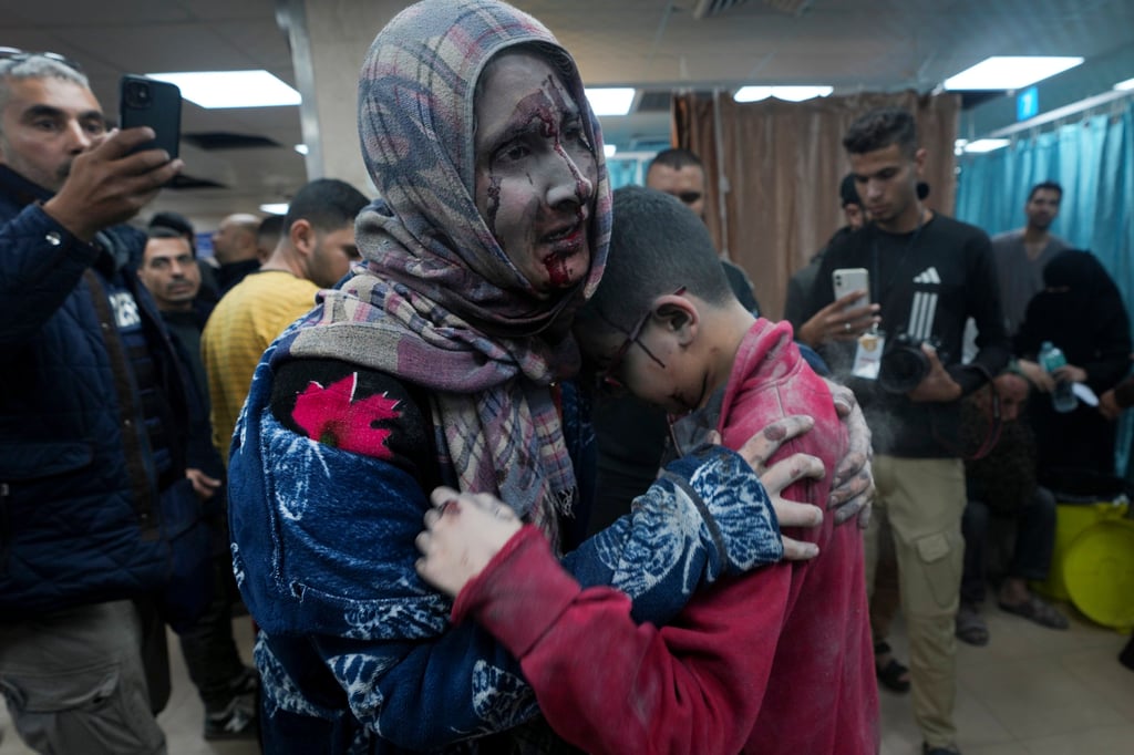 Palestinians wounded in the Israeli bombardment of the Gaza Strip are brought to the hospital in Deir al Balah on Friday. Photo: AP