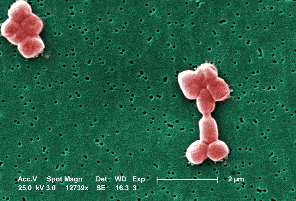 Acinetobacter baumannii, seen under a scanning electron microscope, is a Gram-negative bacterium responsible for thousands of hospitalisations and hundreds of deaths in the US alone each year. An experimental antibiotic has been found to disable it in mice. Photo: Centers for Disease Control and Prevention/TNS Acinetobacter baumannii, seen under a scanning electron microscope, is a Gram-negative bacterium responsible for thousands of hospitalisations and hundreds of deaths in the US alone each year. An experimental antibiotic has been found to disable it in mice. Photo: Centers for Disease Control and Prevention/TNS
