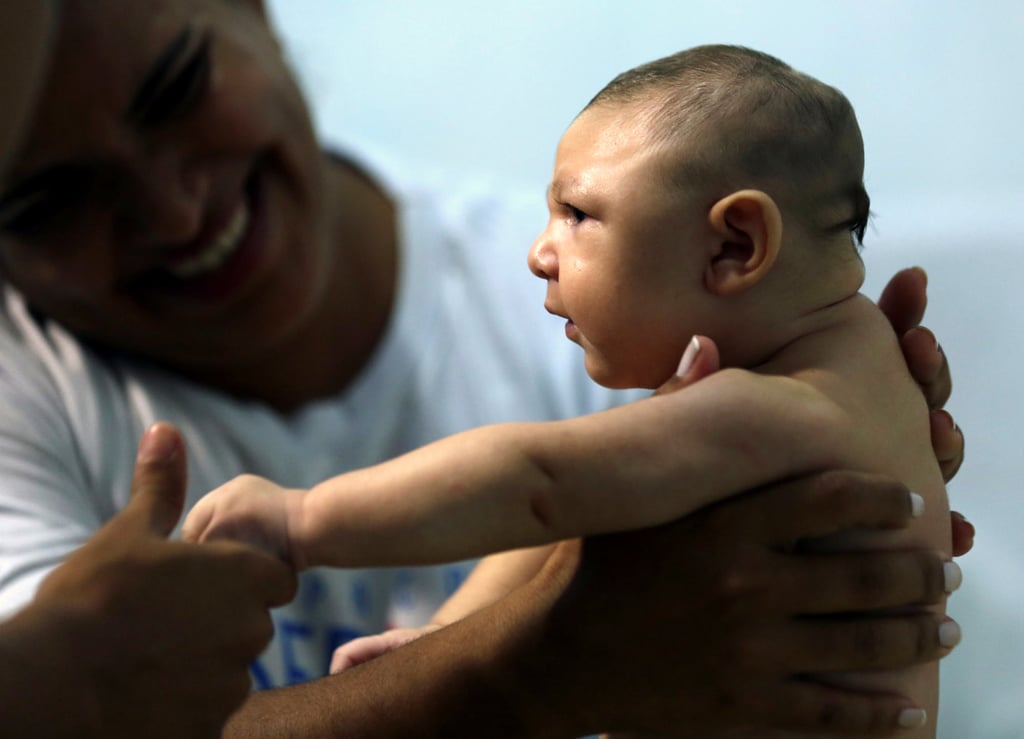 A therapist holds a baby who has microcephaly in Recife, Brazil in March 2016. Photo: Reuters A therapist holds a baby who has microcephaly in Recife, Brazil in March 2016. Photo: Reuters