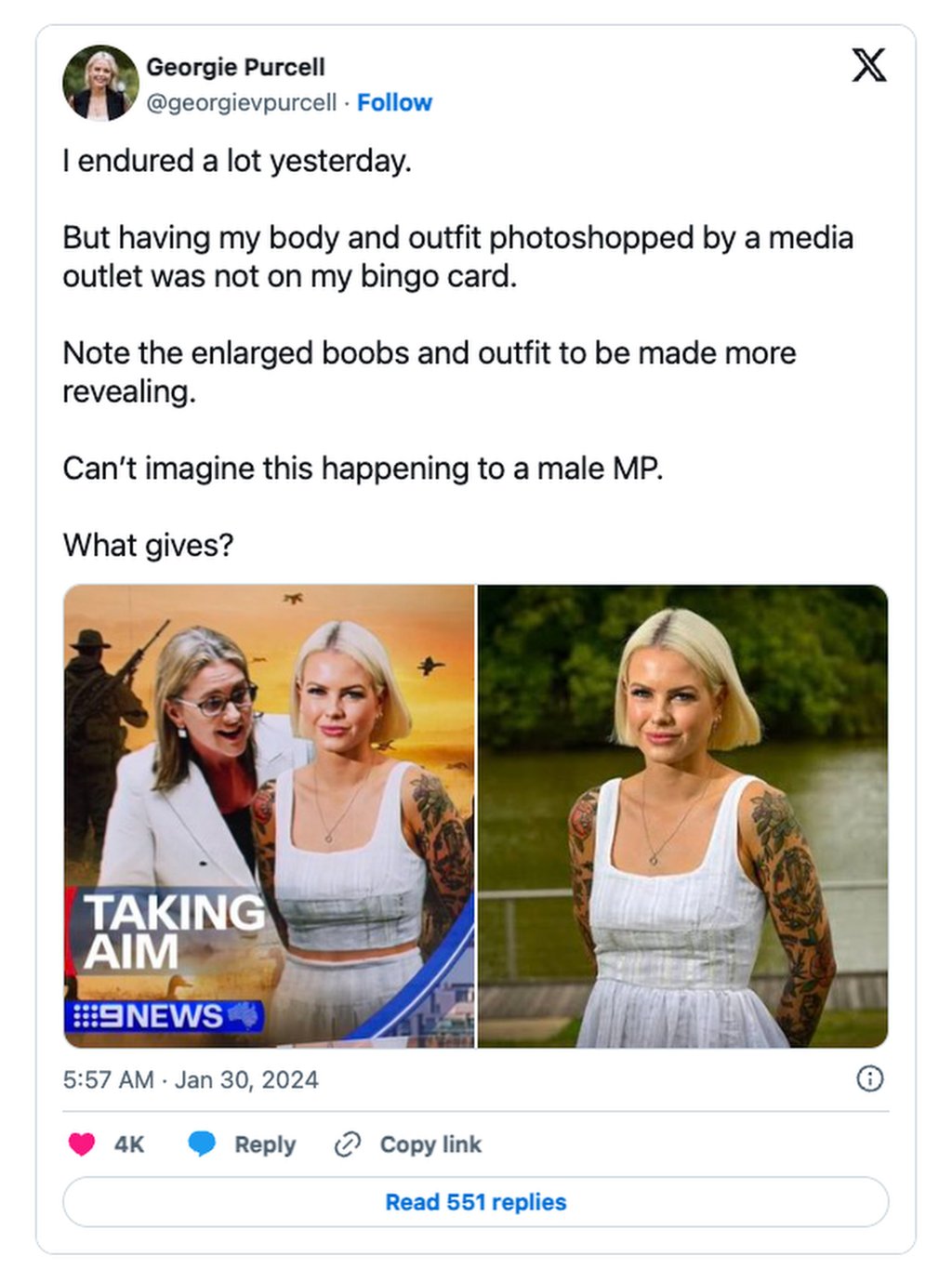 Georgie Purcell posted side-by-side versions of the original and the version edited photo by 9News Melbourne. Photo: X/ @georgievpurcell