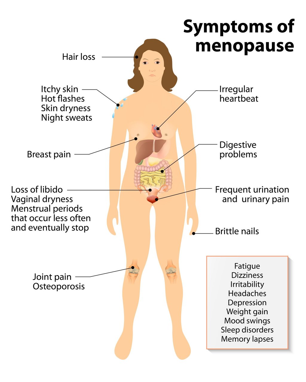 Menopause can have multiple physical and mental symptoms. Illustration: Shutterstock