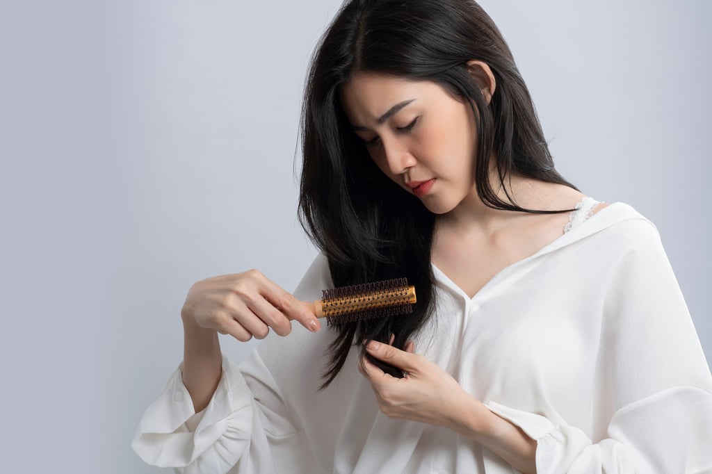 Hair loss, a condition which affects millions, can impact one’s self-esteem. Photo: Shutterstock Hair loss, a condition which affects millions, can impact one’s self-esteem. Photo: Shutterstock