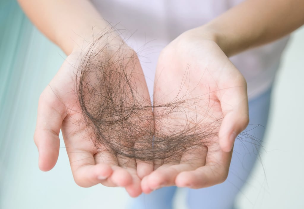Hair loss can now be treated by non-surgical treatments such as microneedling. Photo: Shutterstock Hair loss can now be treated by non-surgical treatments such as microneedling. Photo: Shutterstock