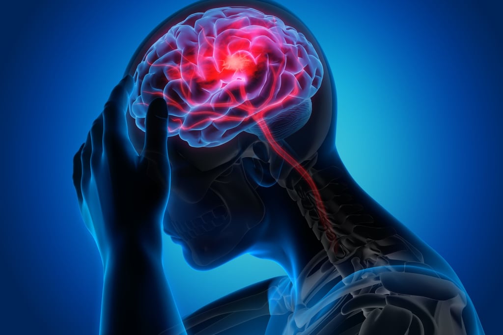 The dementia risk early after stroke may be caused by direct brain injury in parts of the brain that affect cognitive function. But this risk persists for up to 20 years. Photo: Shutterstock