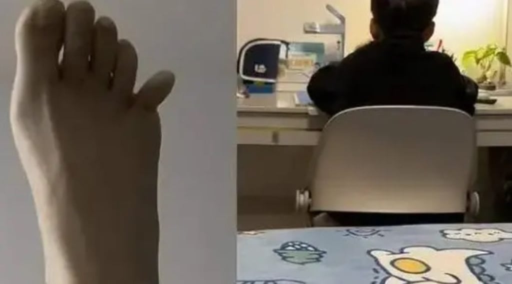 The stressed-out mother kicked the wall so hard that her little toe ended up bent out of shape. Photo: Baidu
