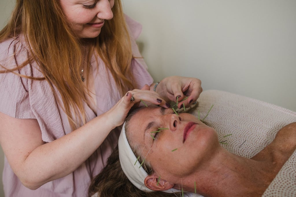 Cosmetic acupuncture treatment helps not only in rejuvenating the face, but also overall wellness. Photo: Dr Krystal Couture Cosmetic acupuncture treatment helps not only in rejuvenating the face, but also overall wellness. Photo: Dr Krystal Couture