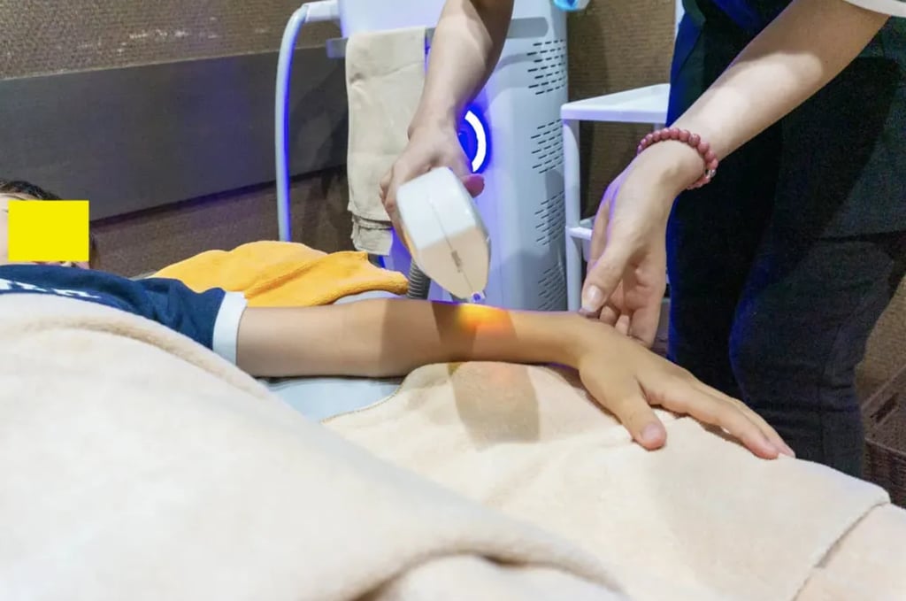 A boy undergoes a hair removal procedure. Experts say such treatments when young can be damaging. Photo: Weixin A boy undergoes a hair removal procedure. Experts say such treatments when young can be damaging. Photo: Weixin