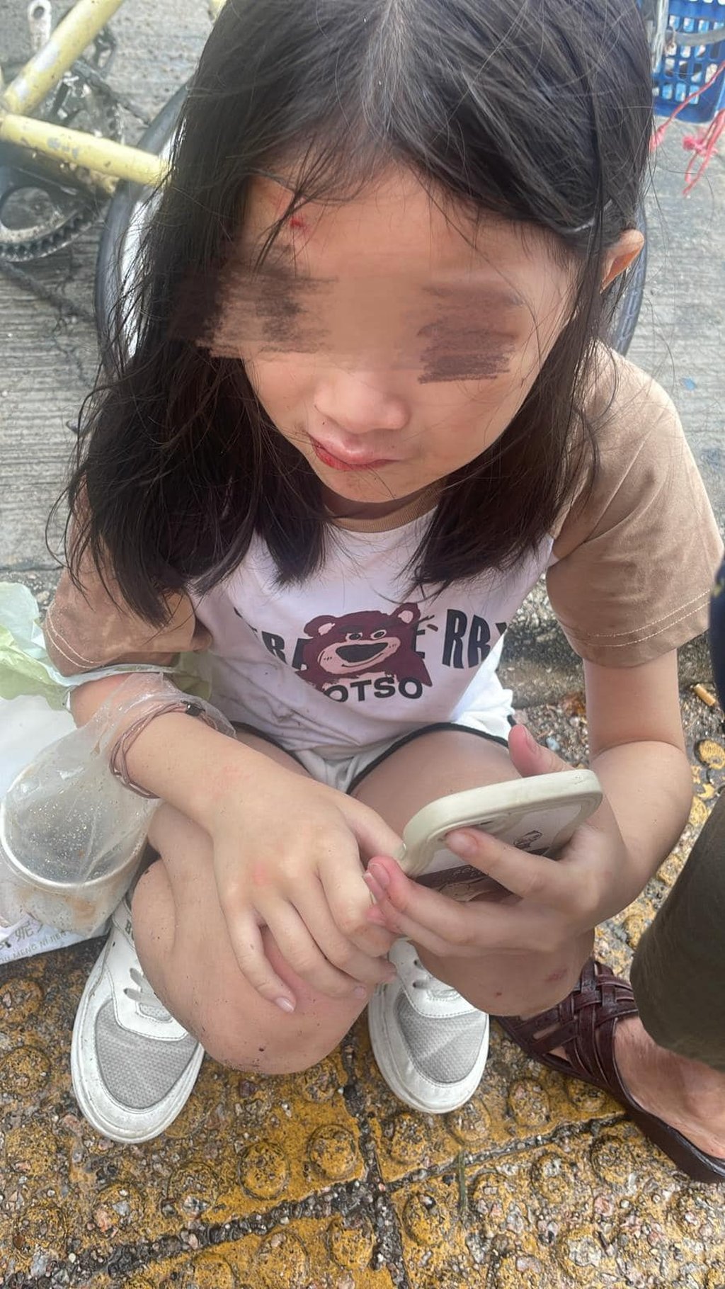 The girl was not seriously hurt but sustained injuries to her head, hands and feet, and one of her teeth was knocked out. Photo: Facebook / @Bling Bling