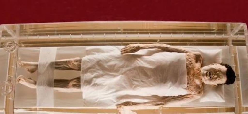 Despite being nearly 2,200 years old, Lady Dai’s body was remarkably well-preserved: her skin was soft, limbs flexible, hair intact, and internal organs in place. Photo: Sina Despite being nearly 2,200 years old, Lady Dai’s body was remarkably well-preserved: her skin was soft, limbs flexible, hair intact, and internal organs in place. Photo: Sina