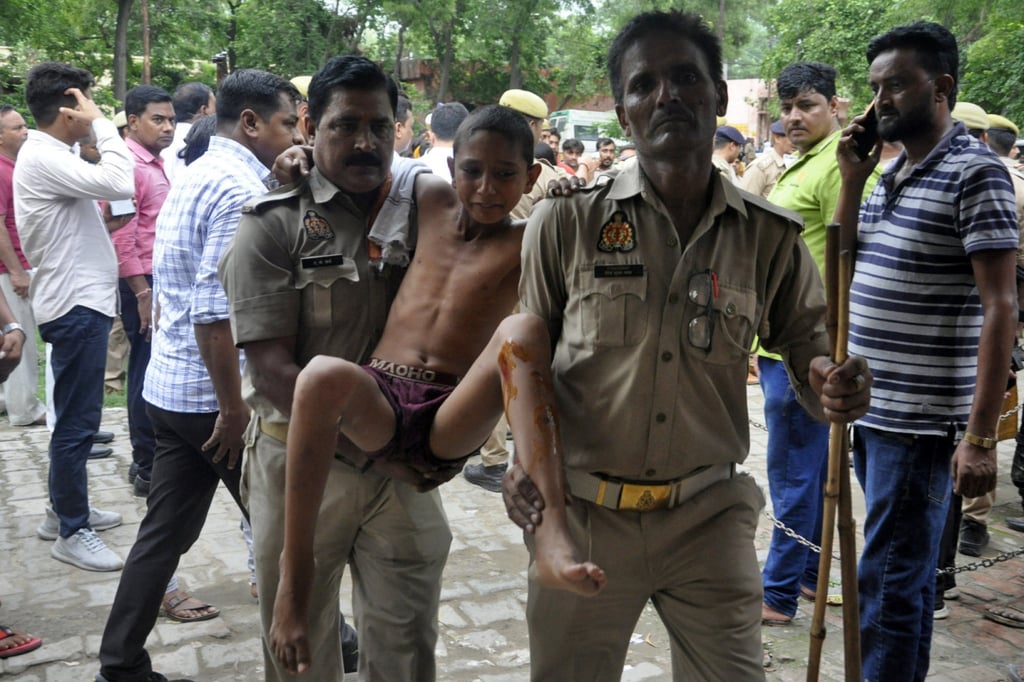 A boy who was injured in a stampede at a religious gathering is brought to a hospital for a treatment in Hathras district, Uttar Pradesh, India on Tuesday. Photo: Reuters