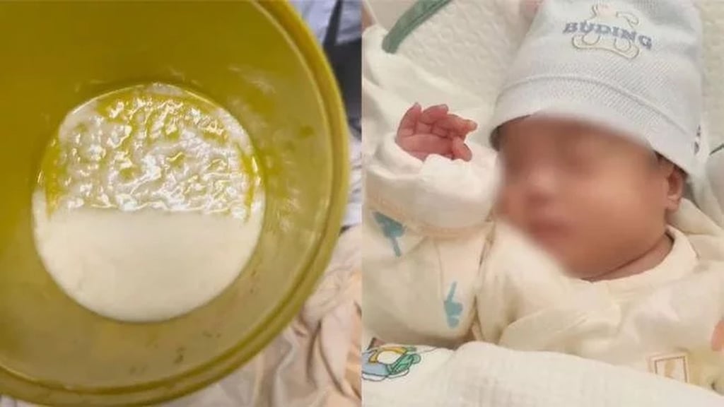 The tragic infant had to have a “significant” amount of milk pumped from its stomach. Photo: Weibo