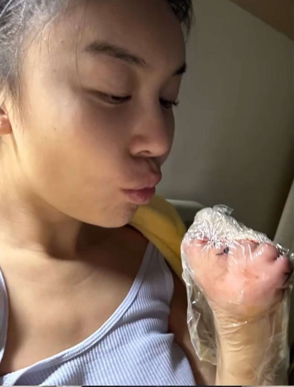 Kiss of life: Du admits she hit the depths of despair after she lost her hand. Photo: Xiaohongshu/jessicadu2.0 Kiss of life: Du admits she hit the depths of despair after she lost her hand. Photo: Xiaohongshu/jessicadu2.0