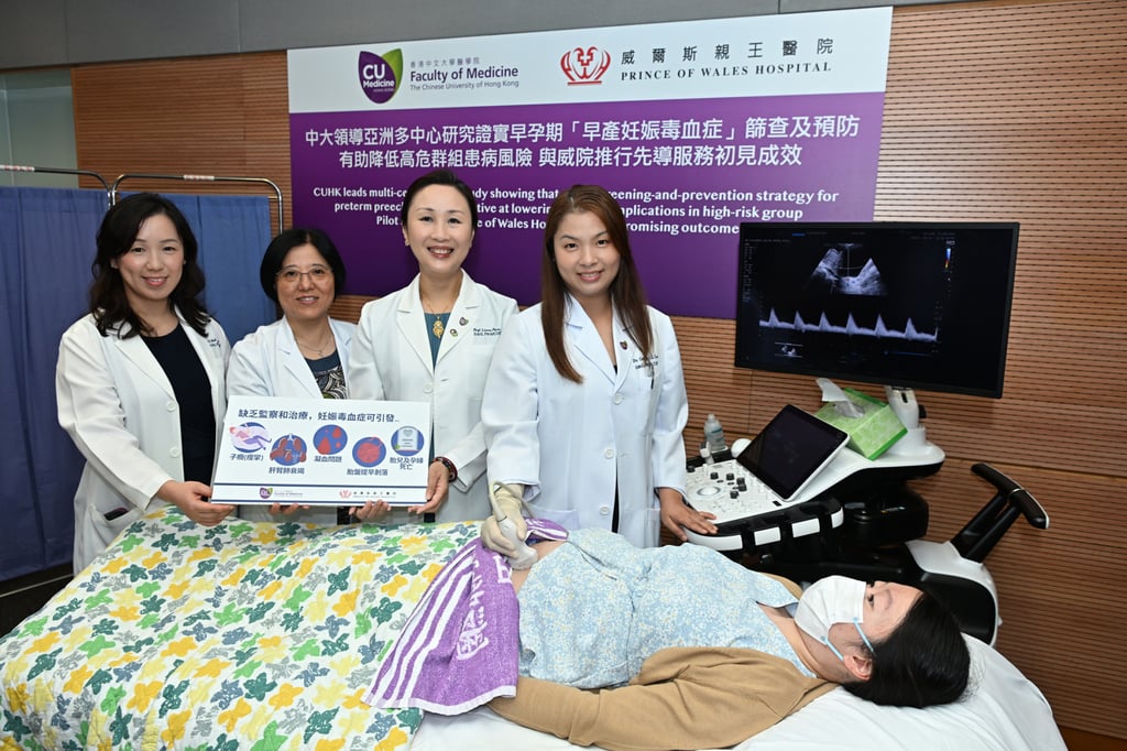 The Chinese University of Hong Kong research team (from left) Dr Isabella Wah, Dr Symphorosa Chan, Professor Liona Poon and Dr Caitlyn Lau. Photo: CUHK