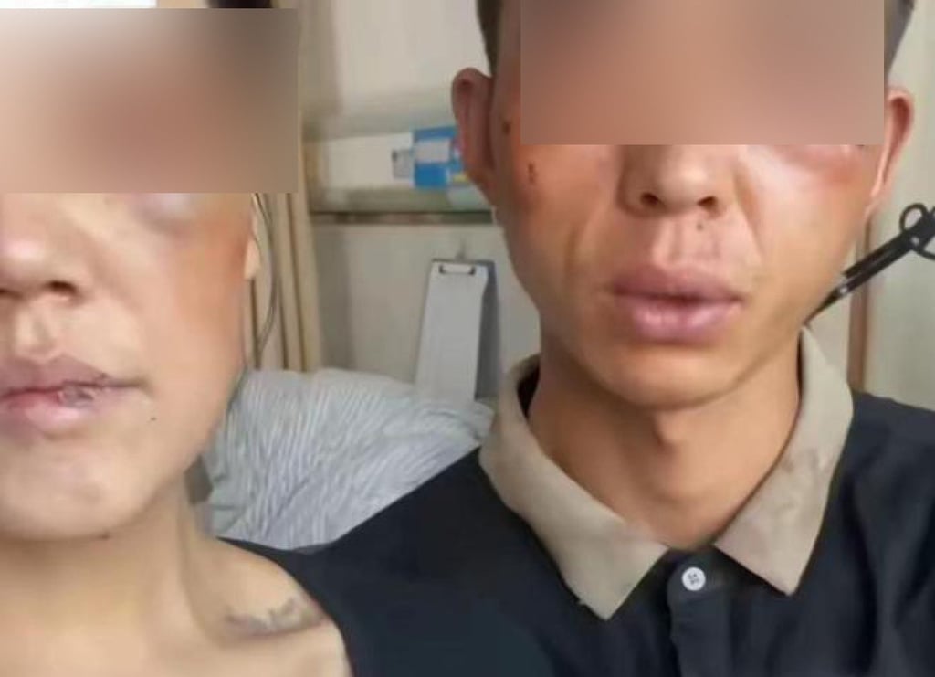 The couple displayed the severity of their injuries inflicted by the bank manager. Photo: 163.com