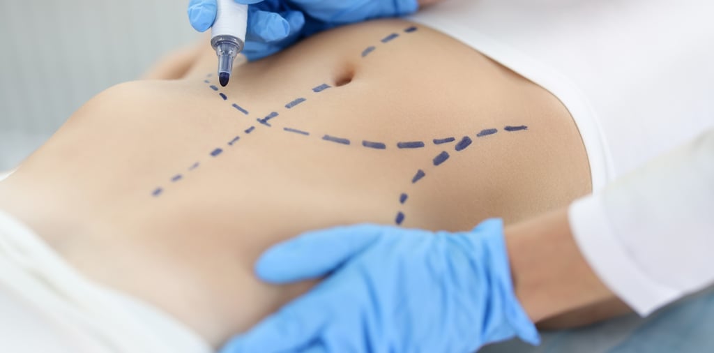 Societal pressure has seen some women turn to cosmetic surgery to ease their feelings of appearance anxiety. Photo: Shutterstock