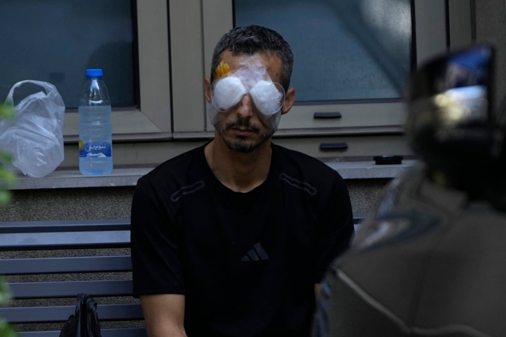 A man who was injured by a blast. Photo: AP
