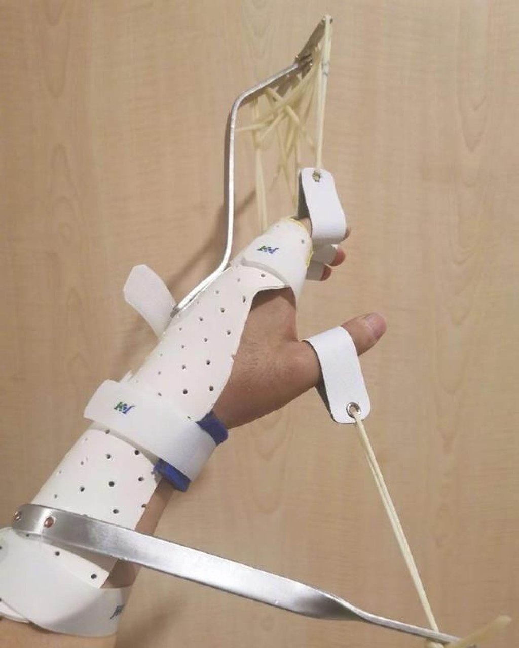Despite the serious injuries, Tao, with determination and resilience, embarked on a challenging journey of rehabilitation and recovery. Photo: 163.com