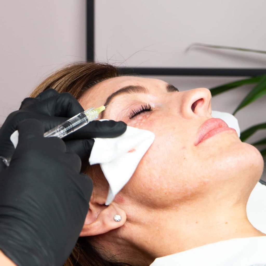 Polynucleotides help accelerate healing in wounds and skin injuries. Photo: BU Aesthetics Polynucleotides help accelerate healing in wounds and skin injuries. Photo: BU Aesthetics