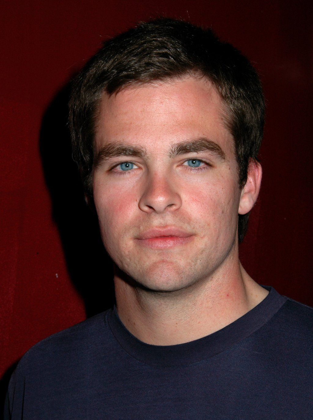 Chris Pine reportedly lost a role in The O.C. over his skin condition. Photo: Getty Images