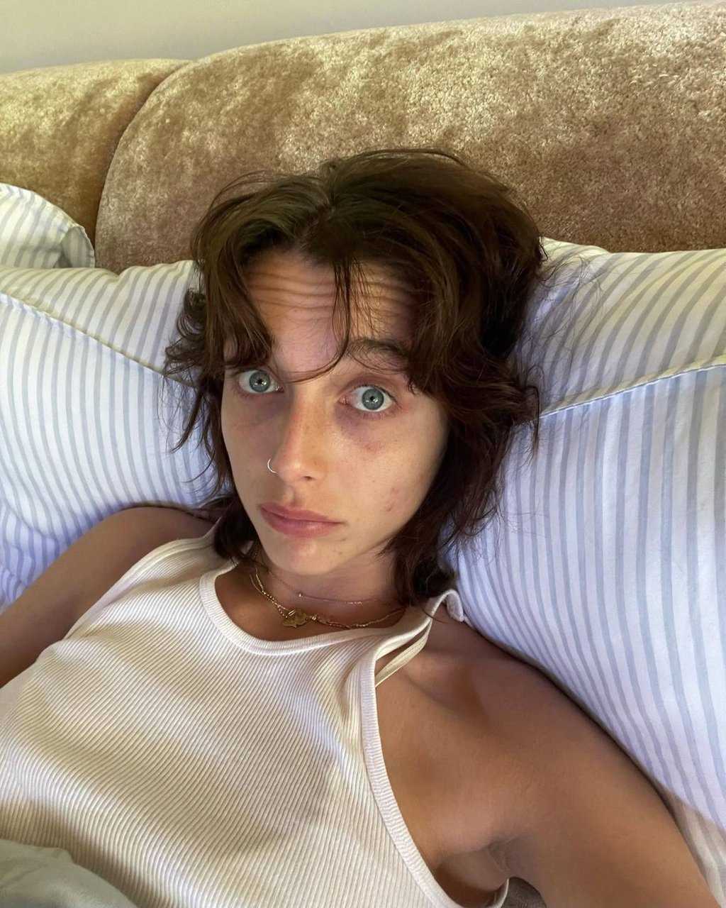 Influencer Emma Chamberlain has also discussed her difficulties with acne. Photo: @emmachamberlain/Instagram