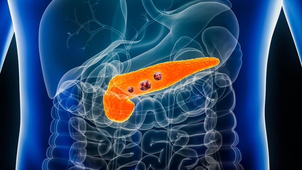 The pancreas, the largest gland in the human body, produces enzymes and hormones that are vital for digestion and metabolism. However, it is also susceptible to disease. Photo: Shutterstock The pancreas, the largest gland in the human body, produces enzymes and hormones that are vital for digestion and metabolism. However, it is also susceptible to disease. Photo: Shutterstock