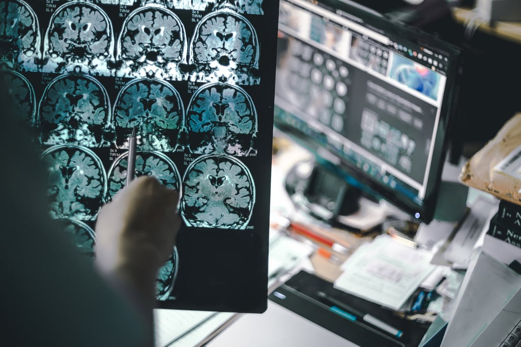Gần 10 triệu người ở Trung Quốc đang sống chung với bệnh Alzheimer. Ảnh: Shutterstock