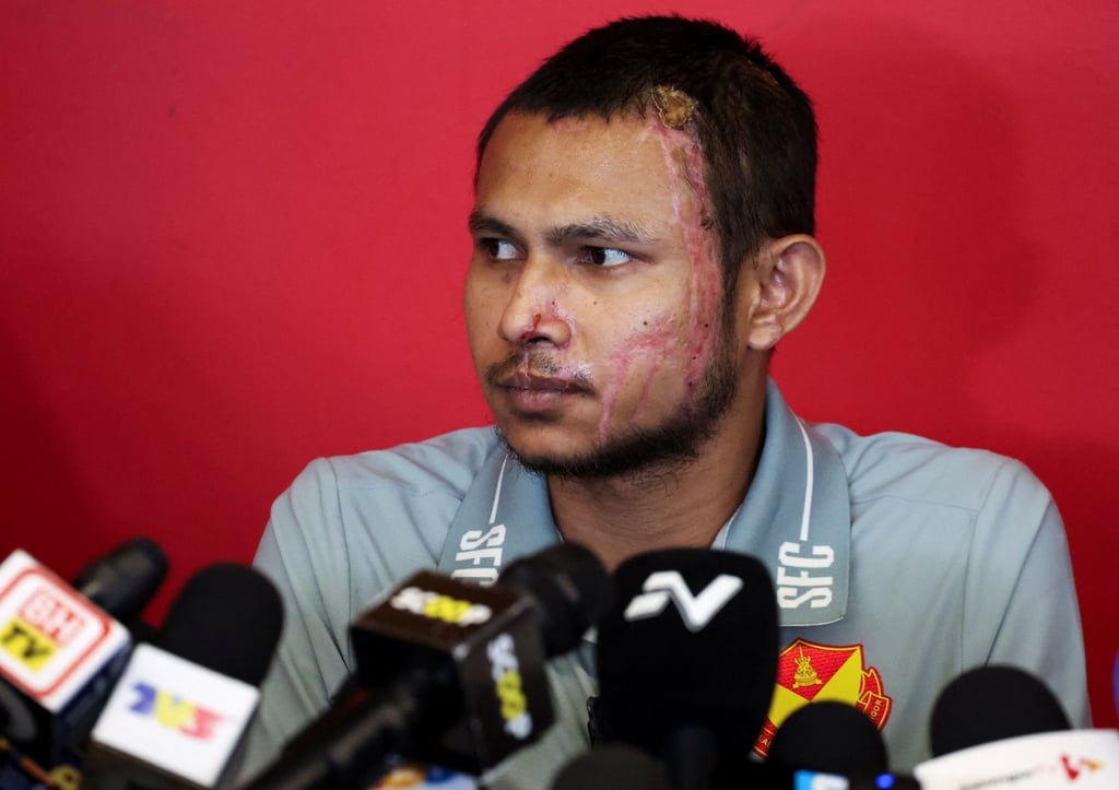 Faisal Halim suffered a second degree burns when he was sprayed with acid in May last year. Photo: Reuters