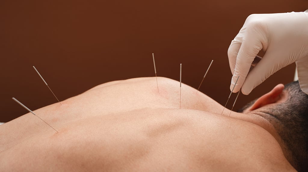 Hospital doctors said Gao would have died if he had arrived at the intensive care unit a minute later than he did following the rogue acupuncture treatment. Photo: Shutterstock Hospital doctors said Gao would have died if he had arrived at the intensive care unit a minute later than he did following the rogue acupuncture treatment. Photo: Shutterstock