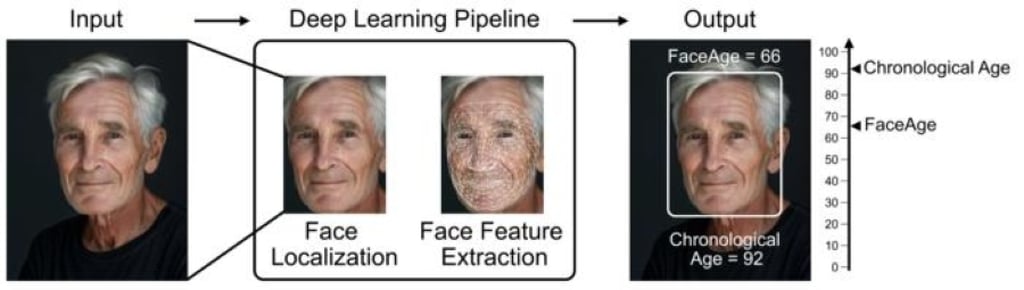 A representation of how FaceAge might be calculated from a photo of a patient. The patient in this photo is AI-generated. Photo: Mass General Brigham A representation of how FaceAge might be calculated from a photo of a patient. The patient in this photo is AI-generated. Photo: Mass General Brigham