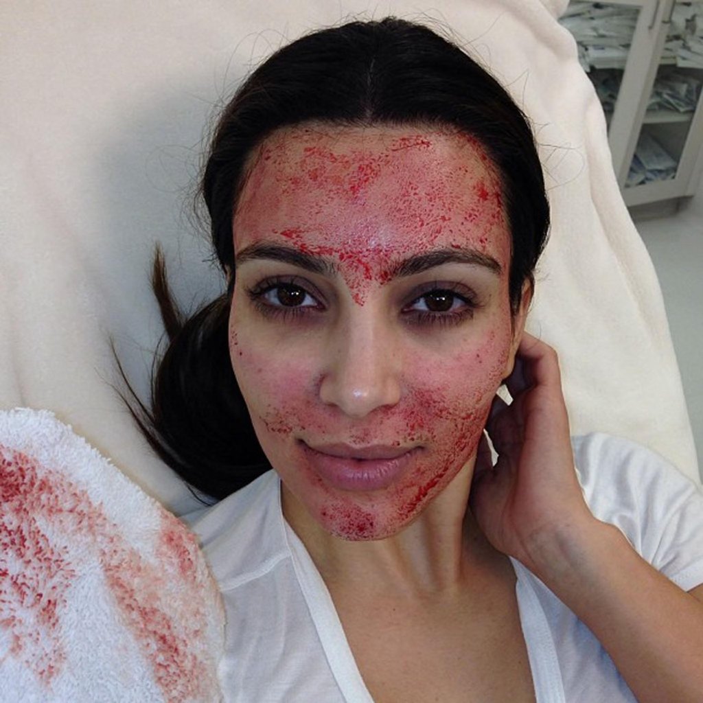 Kim Kardashian iconic “vampire facial” selfie from 2013. Photo: Handout