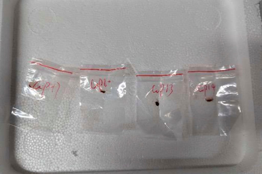 These toxic plant pathogens were found Liu Zunyong’s backpack last year, federal authorities said. Photo: US District Court for the Eastern District of Michigan via AP These toxic plant pathogens were found Liu Zunyong’s backpack last year, federal authorities said. Photo: US District Court for the Eastern District of Michigan via AP