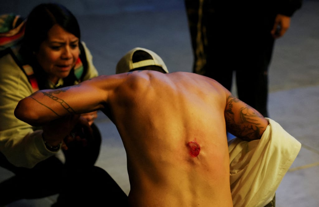 A man hit by a non-lethal munition is assisted by a woman, as people march as part of the ongoing protests against Immigration and Customs Enforcement in Los Angeles on Wednesday. Photo: Reuters A man hit by a non-lethal munition is assisted by a woman, as people march as part of the ongoing protests against Immigration and Customs Enforcement in Los Angeles on Wednesday. Photo: Reuters