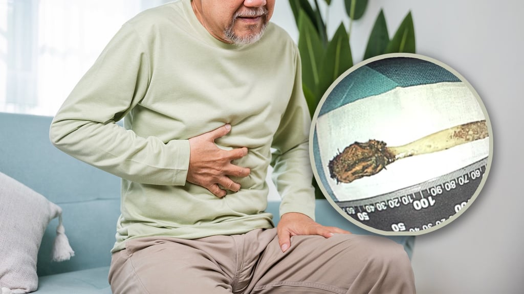 A 64-year-old man in China who swallowed a toothbrush when he was 12 years old has finally had it removed from his stomach in an 80-minute surgical procedure. Photo: SCMP composite/Shutterstock/Douyin A 64-year-old man in China who swallowed a toothbrush when he was 12 years old has finally had it removed from his stomach in an 80-minute surgical procedure. Photo: SCMP composite/Shutterstock/Douyin