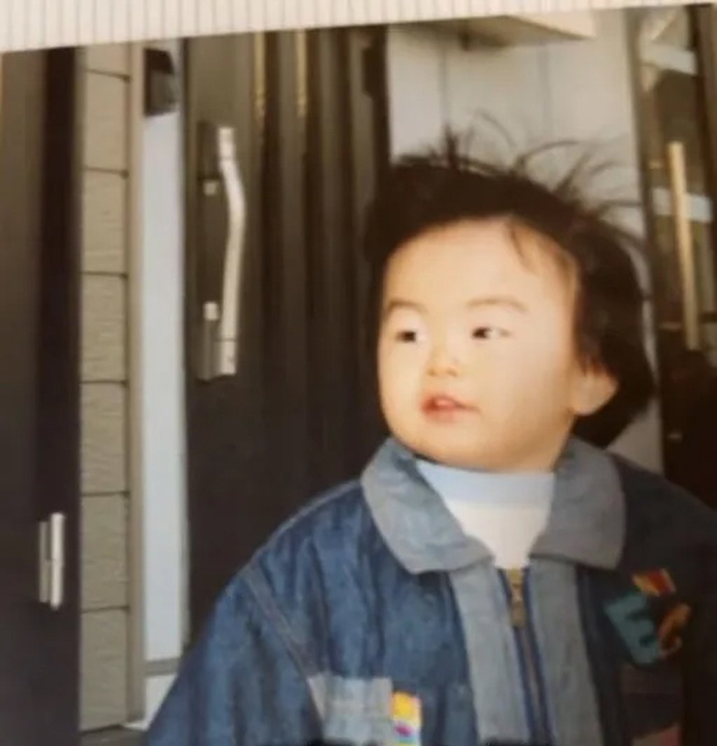 As a toddler, above, Jonouchi looked perfectly normal, but his face began to change when he turned three. Photo: QQ.com