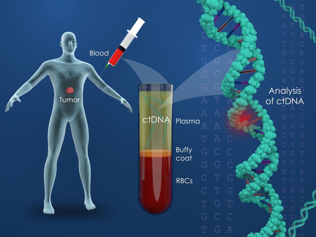 In a ctDNA test, plasma is extracted from a blood sample to check whether there are DNA fragments harbouring cancer. Illustration: Shutterstock In a ctDNA test, plasma is extracted from a blood sample to check whether there are DNA fragments harbouring cancer. Illustration: Shutterstock