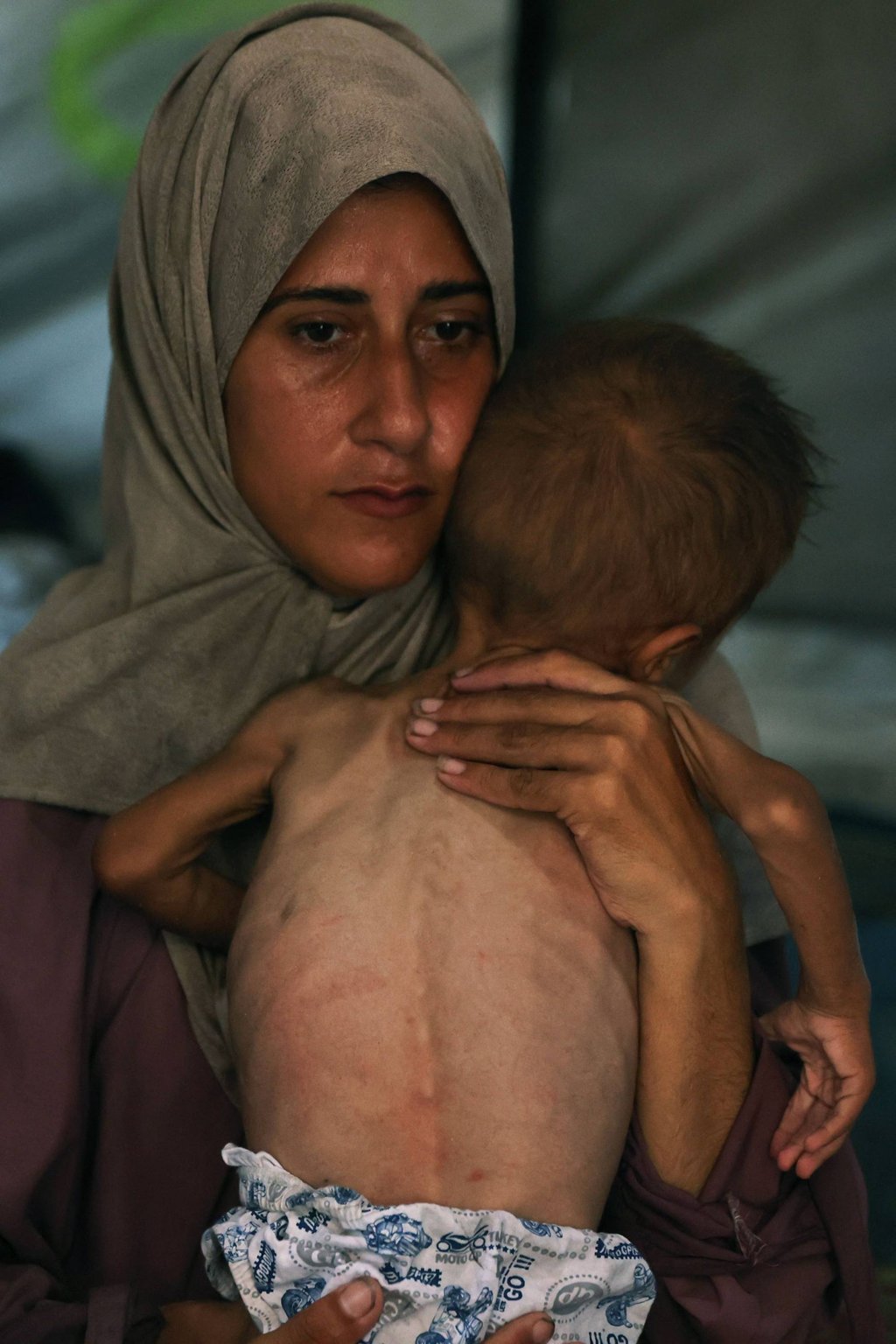 Hidaya, a 31-year-old Palestinian mother, cradles her sick 18-month-old son Mohammed al-Mutawaq, who is also displaying signs of malnutrition, inside their tent at the al-Shati refugee camp, west of Gaza City, on July 24, 2025. Photo: AFP Hidaya, a 31-year-old Palestinian mother, cradles her sick 18-month-old son Mohammed al-Mutawaq, who is also displaying signs of malnutrition, inside their tent at the al-Shati refugee camp, west of Gaza City, on July 24, 2025. Photo: AFP
