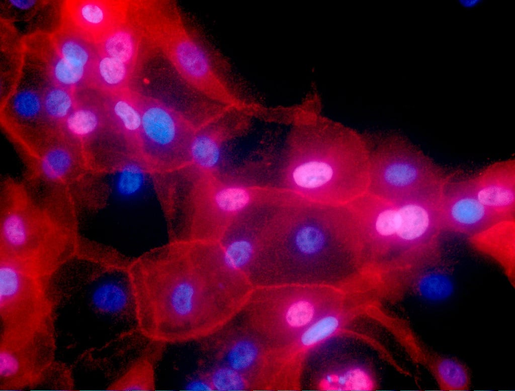 Team based in China also finds that the use of specific drugs in combination with chemotherapy could be used to inhibit this process in mice, with a clinical trial already under way in breast cancer patients. Photo: AP Team based in China also finds that the use of specific drugs in combination with chemotherapy could be used to inhibit this process in mice, with a clinical trial already under way in breast cancer patients. Photo: AP