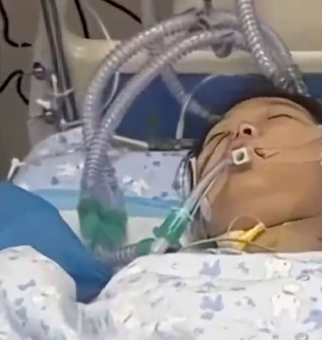 Jiang Chennan in her hospital bed. She slipped into a coma and was being kept alive artificially. Photo: handout