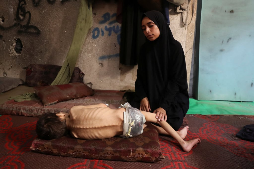 Displaced Palestinian mother Samah Matar sits next to her malnourished son Youssef in Gaza. Images Trump has seen on have swayed presidential decisions on Gaza and global diplomacy. Photo: Reuters