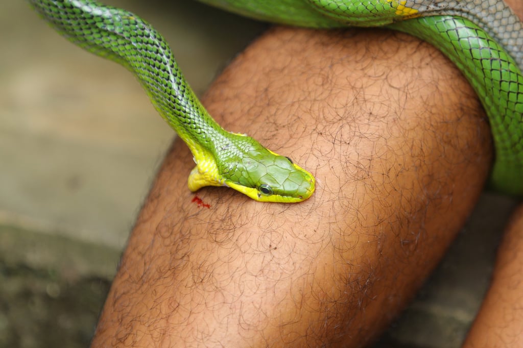Snake bites kill more than 100,000 people globally every year. Photo: Shutterstock