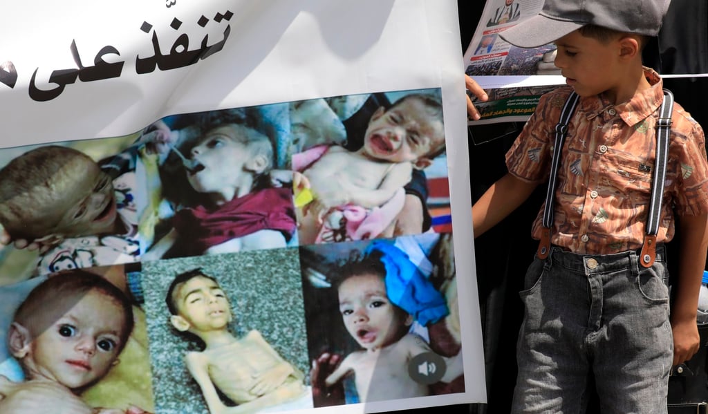 A child looks at a banner showing images of starving children during a rally in solidarity with the Palestinian people at Sana’a University in Yemen on July 30. Photo: EPA