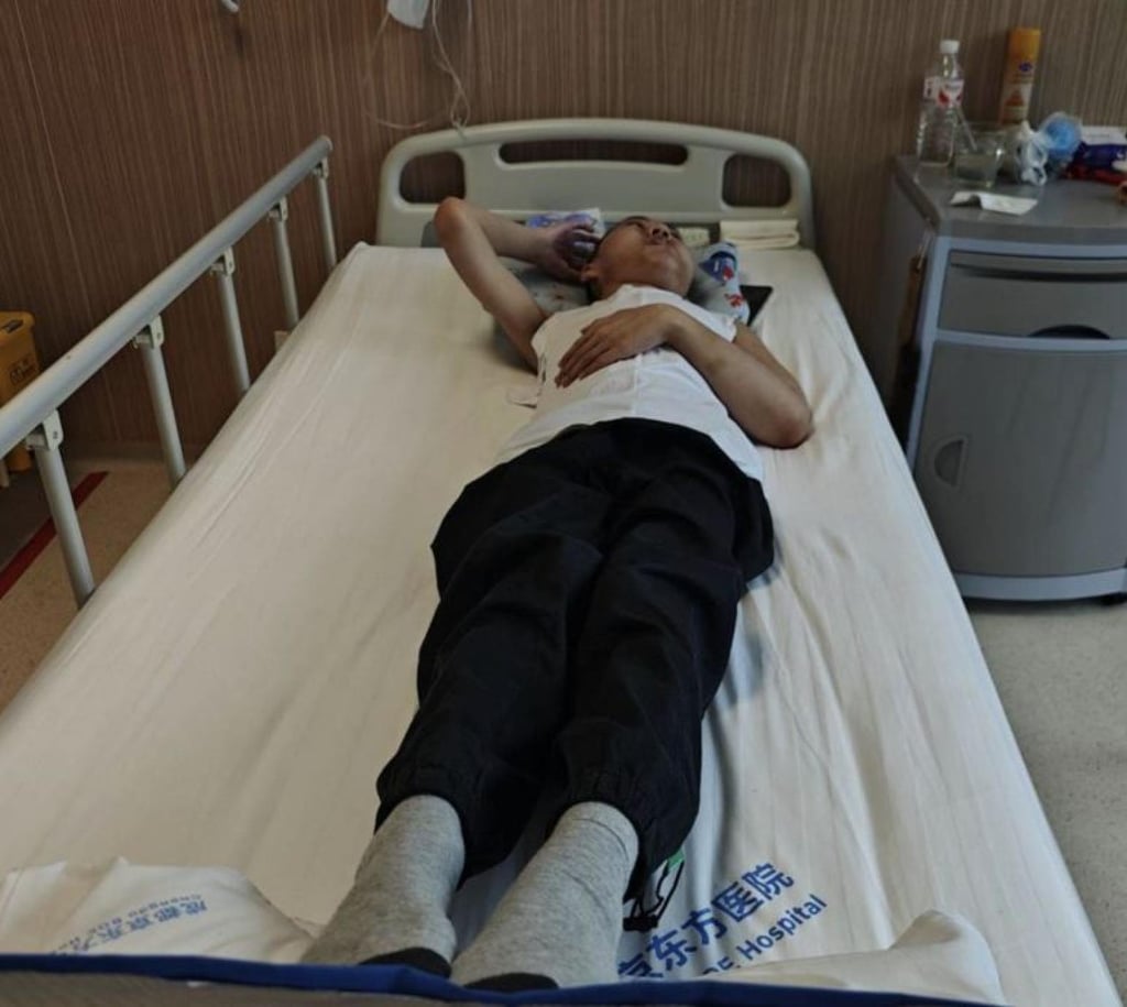 Setelah menjalani operasi terakhir, Jiang dapat berbaring telentang di ranjang rumah sakitnya. Foto: Handout