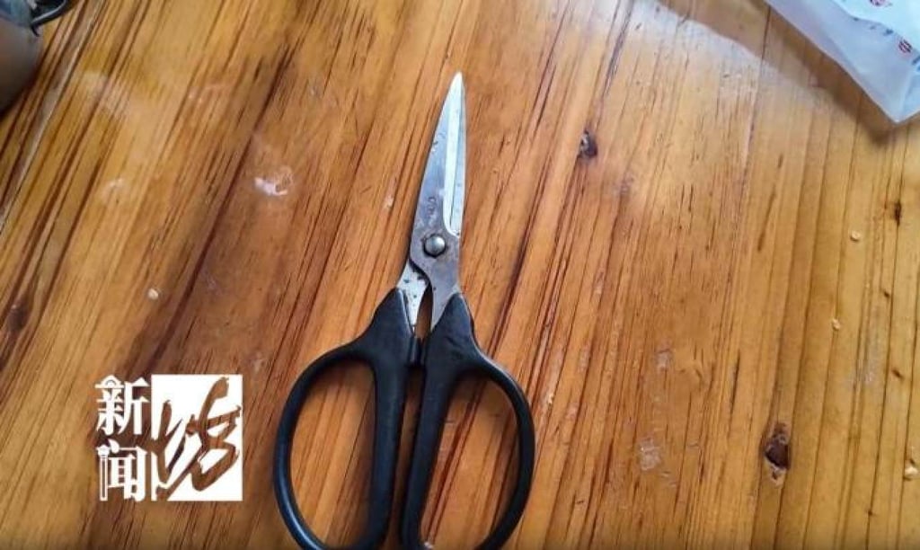 Nonagenarian Gu became so annoyed with the growth that she went at it with a pair of scissors. Photo: Handout Nonagenarian Gu became so annoyed with the growth that she went at it with a pair of scissors. Photo: Handout