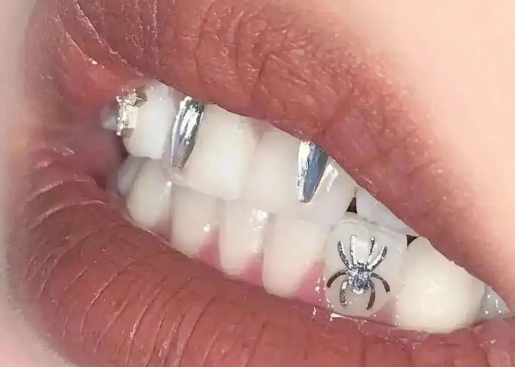 Spider engraved caps are just one of many designs on offer at dental clinics nationwide. Photo: Handout