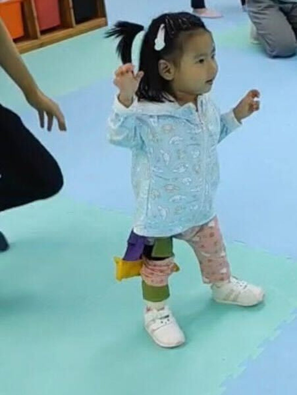 Unlike other children her age, Suet-yee cannot walk by herself and both sides of her body must be held to make a few steps. Photo: Family of Little Suet-yee