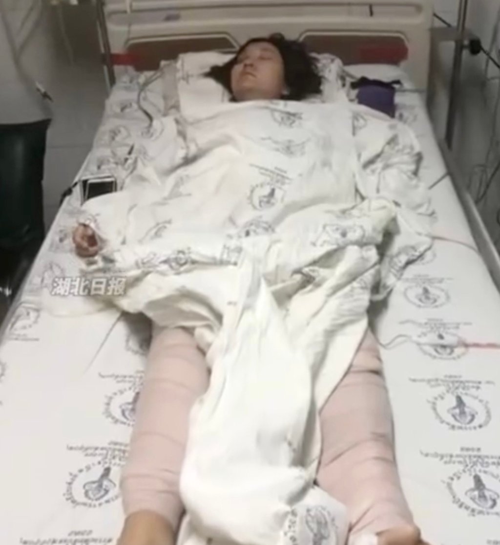 At that time, Wang, above, was pregnant and had endured 17 bone fractures, multiple surgeries, over 100 steel pins, and 200 stitches. Photo: Handout At that time, Wang, above, was pregnant and had endured 17 bone fractures, multiple surgeries, over 100 steel pins, and 200 stitches. Photo: Handout