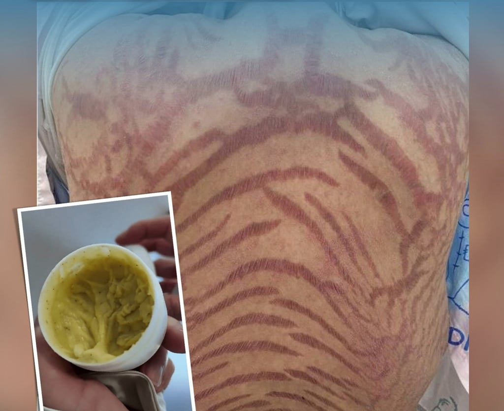 The seller asserted that the cream, above, was composed of “pure traditional Chinese medicine” and had the ability to “cure all types of skin diseases”. Photo: Douyin The seller asserted that the cream, above, was composed of “pure traditional Chinese medicine” and had the ability to “cure all types of skin diseases”. Photo: Douyin