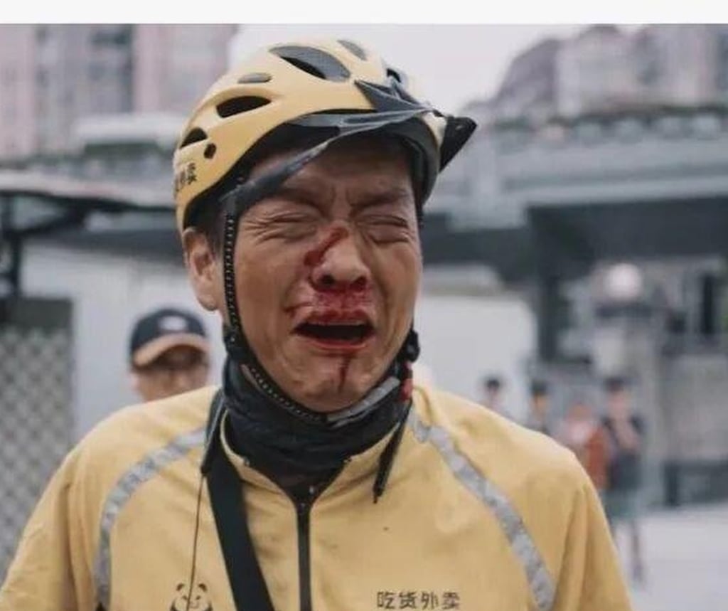 A bloodied delivery worker. China’s state broadcaster has been panned for glorifying a tough job. Photo: Baidu A bloodied delivery worker. China’s state broadcaster has been panned for glorifying a tough job. Photo: Baidu
