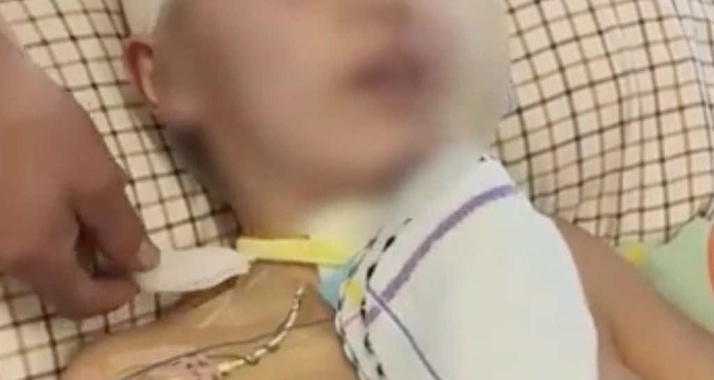 Yuanyuan suffered severe injuries, including head trauma, facial injuries, and multiple bone fractures, leading to a deep coma after a craniotomy. Photo: Baidu Yuanyuan suffered severe injuries, including head trauma, facial injuries, and multiple bone fractures, leading to a deep coma after a craniotomy. Photo: Baidu